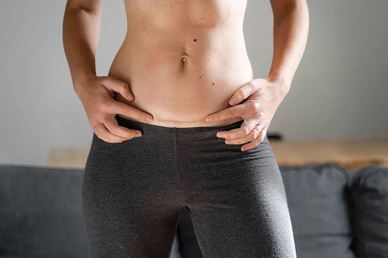 woman with c section scar on her abdomen 2021 11 24 19 33 21 utc